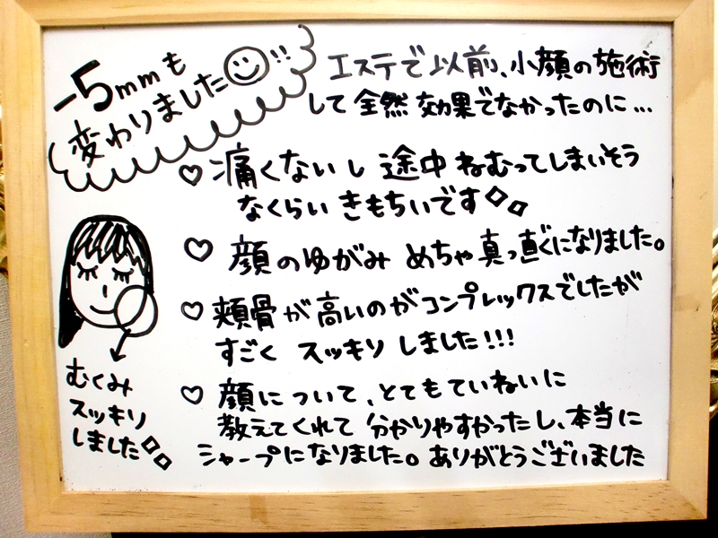 小顔矯正の感想